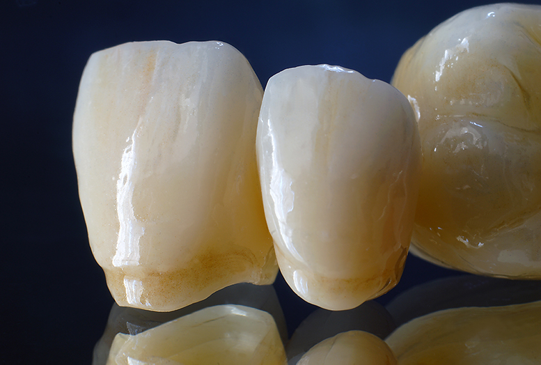 Conventional sintering of nano-crystalline Yttria-Stabilized Zirconia enables high-strength, highly translucent and opalescent dental ceramics